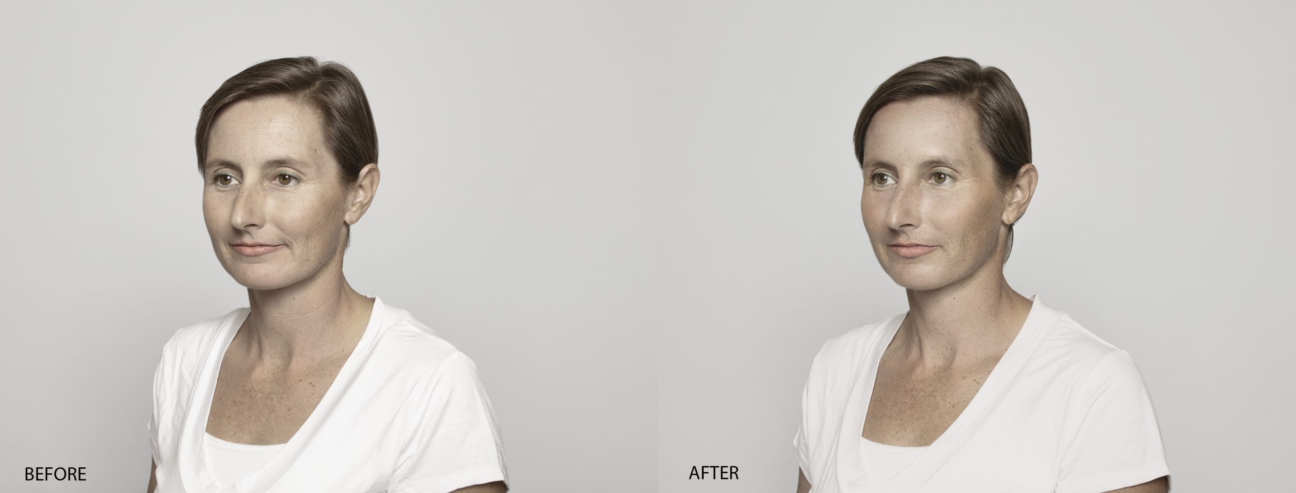 Anne Laure Before and After